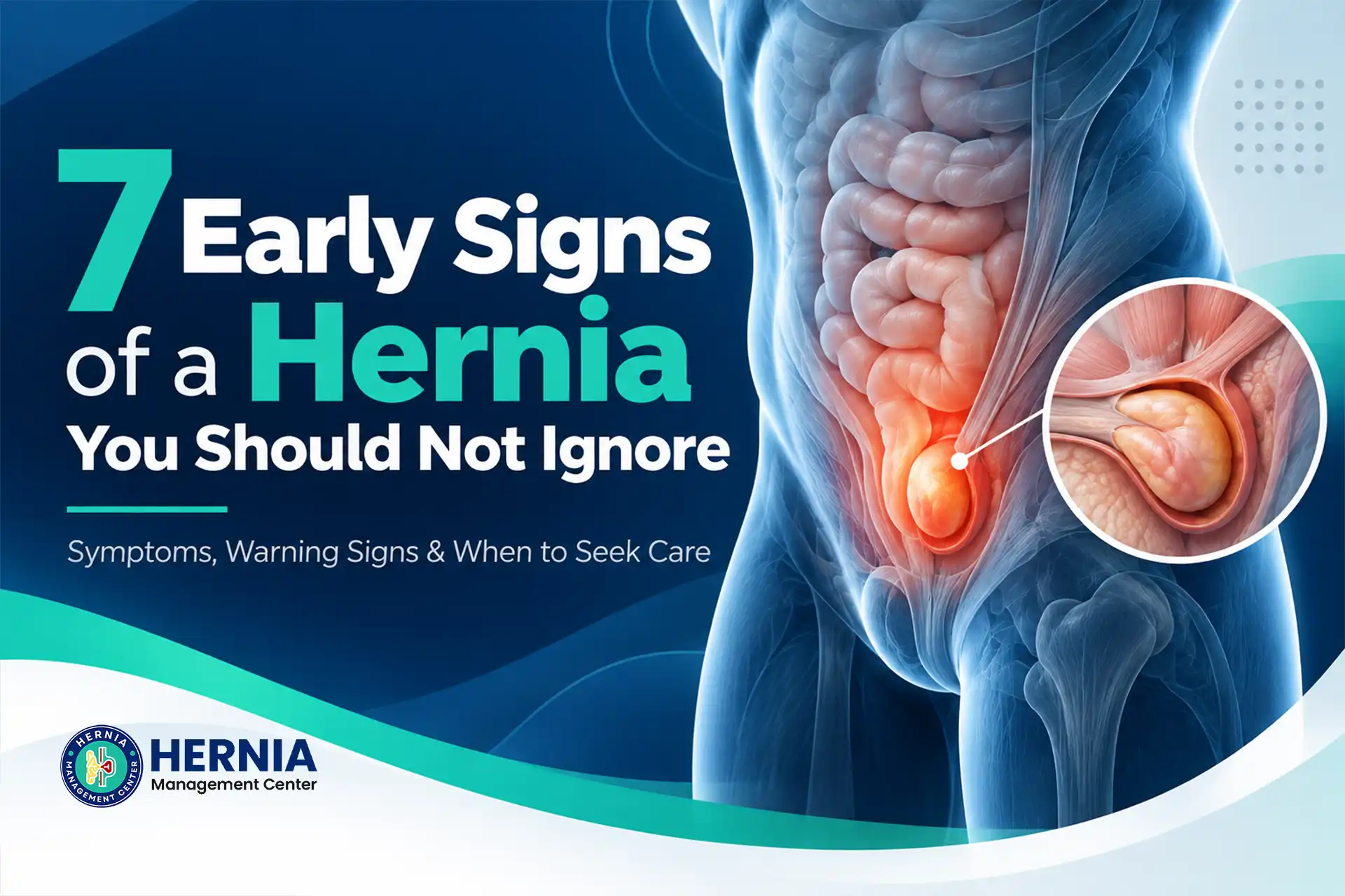 7 Early Signs of a Hernia You Should Not Ignore